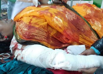 কাটোয়ায় পিক আপ ভ্যানের ধাক্কায় হাত থেঁতলে গেল বাসযাত্রী মহিলার