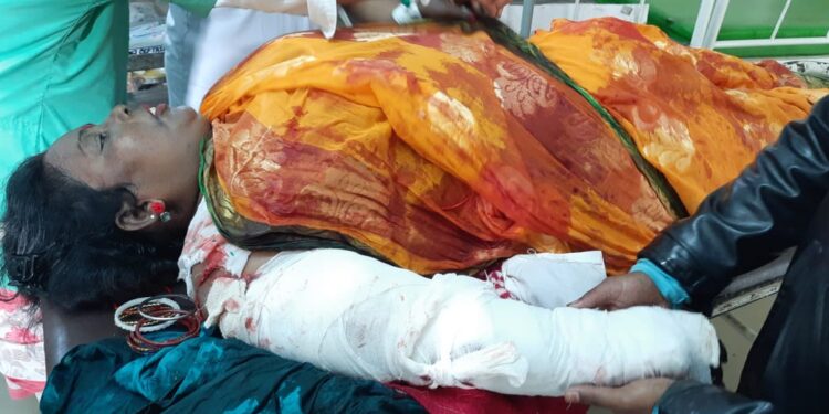 কাটোয়ায় পিক আপ ভ্যানের ধাক্কায় হাত থেঁতলে গেল বাসযাত্রী মহিলার