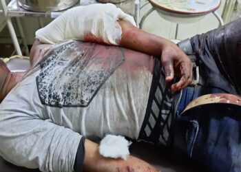 পূর্বস্থলীতে দুষ্কৃতিদের হামলায় গুরুতর জখম দুই ভাই