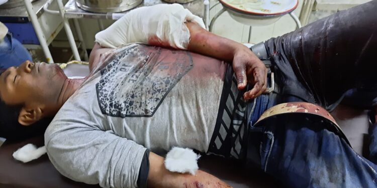 পূর্বস্থলীতে দুষ্কৃতিদের হামলায় গুরুতর জখম দুই ভাই