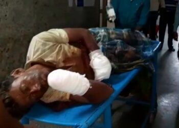 বোমা বাঁধতে গিয়ে বিস্ফোরণ, দু’হাত খোয়ালো দুষ্কৃতি