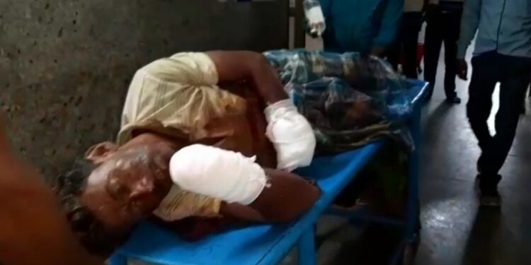 বোমা বাঁধতে গিয়ে বিস্ফোরণ, দু’হাত খোয়ালো দুষ্কৃতি