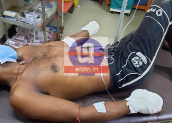 বোমা বাঁধার সময় বিস্ফোরণ,গুরুতর জখম দুষ্কৃতি