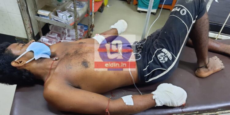 বোমা বাঁধার সময় বিস্ফোরণ,গুরুতর জখম দুষ্কৃতি