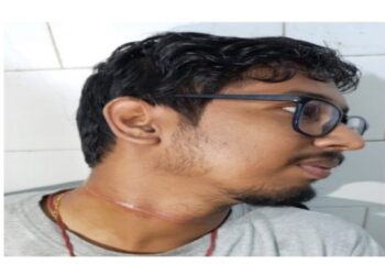 কাটোয়ায় নিষিদ্ধ চায়না সুতোয় জখম বাইক আরোহী যুবক