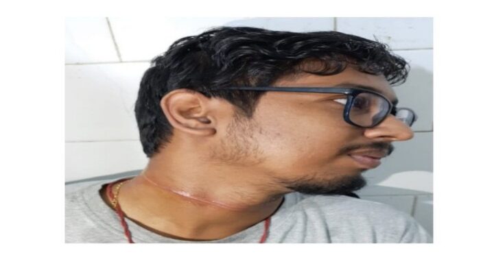 কাটোয়ায় নিষিদ্ধ চায়না সুতোয় জখম বাইক আরোহী যুবক