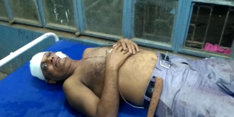 বীরভূমের হেতমপুর জঙ্গলে পুলিশ শেডের কাছেই ব্যাবসায়ীকে মারধর করে লুটপাট দুষ্কৃতিদের