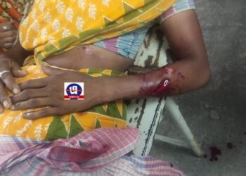 যৌন লালসা পূরণে বাধা পেয়ে বিধবাকে ছুরিকাঘাত, গ্রেফতার কিশোর