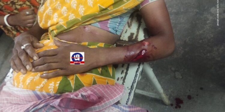 যৌন লালসা পূরণে বাধা পেয়ে বিধবাকে ছুরিকাঘাত, গ্রেফতার কিশোর