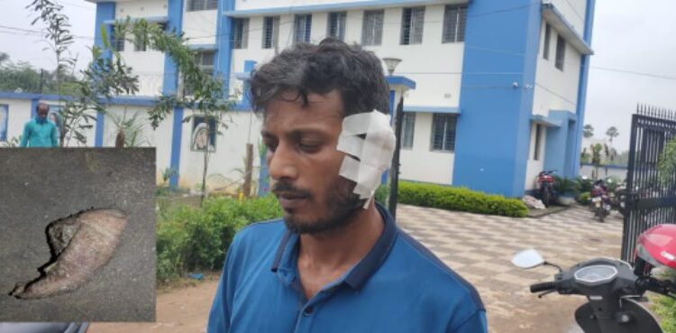 পুরকর্মীর কান কামড়ে ছিড়ে নিল মদ্যপ যুবক