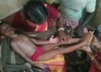 বিদ্যুতের খুঁটিতে হাত লেগে বিদ্যুৎস্পৃষ্ট শিশুকন্যা, বিক্ষোভ