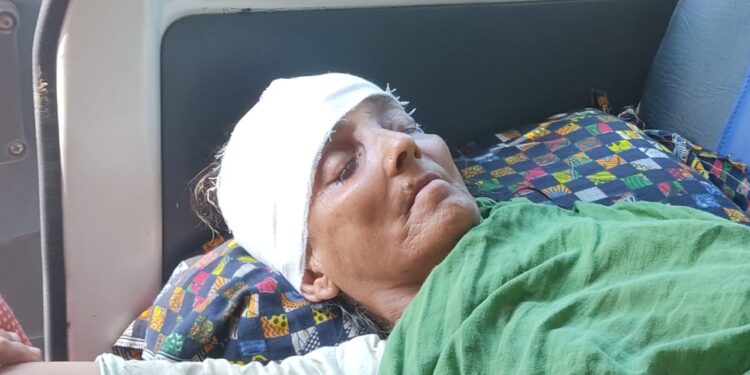 জল নিকাশি নিয়ে বিবাদের জেরে মহিলার মাথায় কোদালের কোপ !