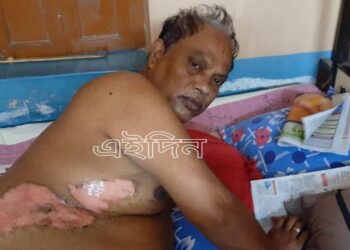 কাটোয়ায় ময়লা ফেলা নিয়ে দুই প্রতিবেশীর ঝামেলার মিমাংসা করতে গিয়ে এক পক্ষের ছোড়া গরম জলে দগ্ধ দুই তৃণমূল কর্মী, গ্রেফতার ৩