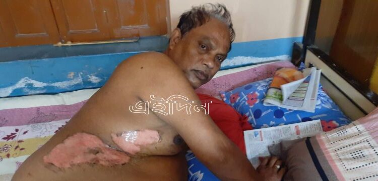 কাটোয়ায় ময়লা ফেলা নিয়ে দুই প্রতিবেশীর ঝামেলার মিমাংসা করতে গিয়ে এক পক্ষের ছোড়া গরম জলে দগ্ধ দুই তৃণমূল কর্মী, গ্রেফতার ৩