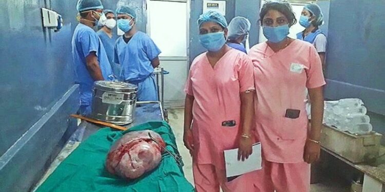 অস্ত্রোপচার করে  কিশোরীর পেট থেকে উদ্ধার হল ৮ কেজির টিউমার,  বড়সড় সাফল্য পেল বাঁকুড়া সম্মিলনী মেডিক্যাল কলেজ হাসপাতাল