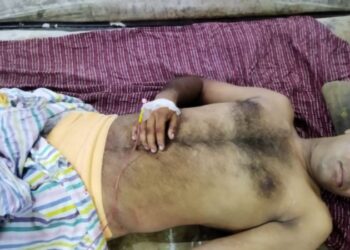 সিভিক ভলেন্টিয়ার্সের যৌনাঙ্গ কেটে দেওয়ার অভিযোগ