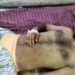 সিভিক ভলেন্টিয়ার্সের যৌনাঙ্গ কেটে দেওয়ার অভিযোগ