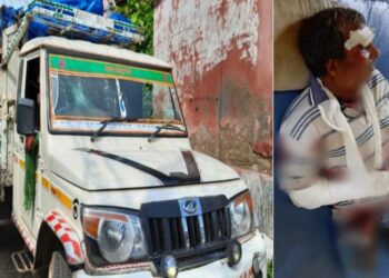 কাটোয়ায় বেপরোয়া পিকআপ ভ্যানের ধাক্কা, প্রাণ বাঁচলেও হাত খোয়ালেন সাইকেল আরোহী