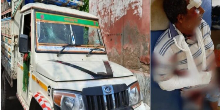 কাটোয়ায় বেপরোয়া পিকআপ ভ্যানের ধাক্কা, প্রাণ বাঁচলেও হাত খোয়ালেন সাইকেল আরোহী