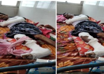 মেরে হাত পা ভেঙে দিয়ে ব্যবসায়ীর কাছ থেকে লক্ষাধিক টাকা ছিনিয়ে নেবার অভিযোগ দুস্কৃতিদের বিরুদ্ধে