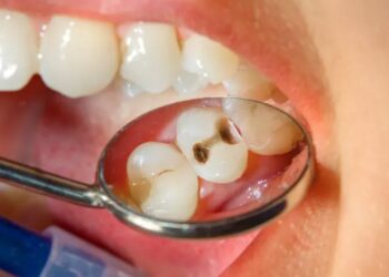 ভুয়ো দন্ত চকিৎসকের বিরুদ্ধে খুনের চেষ্টা ও  প্রতারণার ধারায় মামলা রুজুর নির্দেশ দিল বর্ধমান আদালত