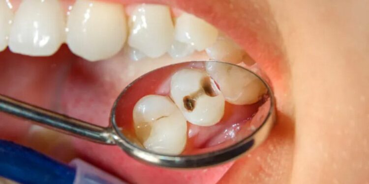 ভুয়ো দন্ত চকিৎসকের বিরুদ্ধে খুনের চেষ্টা ও প্রতারণার ধারায় মামলা রুজুর নির্দেশ দিল বর্ধমান আদালত