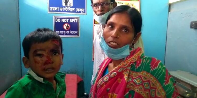 পাগল কুকুরের কামড়ে শিশু ও বয়স্ক মিলিয়ে একই দিনে মন্তেশ্বরে জখম ৩০ জন