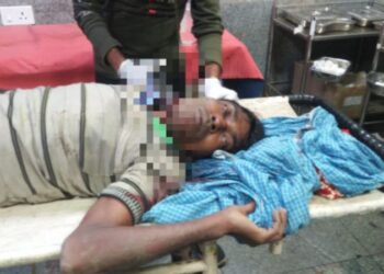 স্বামীকে ধারালো অস্ত্র দিয়ে কোপানোর অভিযোগ স্ত্রীর বিরুদ্ধে