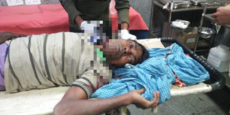 স্বামীকে ধারালো অস্ত্র দিয়ে কোপানোর অভিযোগ স্ত্রীর বিরুদ্ধে