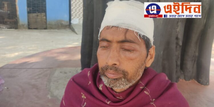 গোপনে নজর রাখার অভিযোগ তুলে প্রতিবেশী প্রৌঢ়ের চোখে অ্যাসিড ছোড়ার অভিযোগ মহিলার বিরুদ্ধে