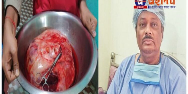 ভাতারে বেসরকারি নার্সিংহোমে জটিল অস্ত্রোপচার,গৃহবধুর পেট থেকে বেরিয়ে এল ৫ কেজি টিউমার