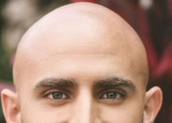 ‘টাক’ নিয়ে মন্তব্য যৌন হয়রানির সমতুল্য বলে রায় দিল ব্রিটেনের আদালত