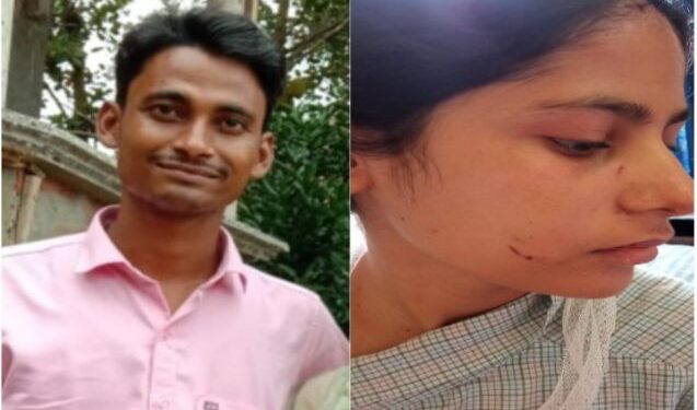 সরকারি চাকরি করলে হাতছাড়া হবে বউ, এই আশঙ্কায় স্ত্রীর হাত কেটে নিল গুনধর স্বামী