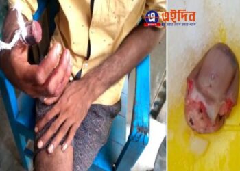 সাপ নয়, ঝাপানতলায় এক মনসা ভক্তের ডান হাতের বুড়ো আঙুল কামড়ে কেটে বিচ্ছিন্ন করে দিল মদ্যপ ব্যক্তি