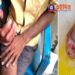 সাপ নয়, ঝাপানতলায় এক মনসা ভক্তের ডান হাতের বুড়ো আঙুল কামড়ে কেটে বিচ্ছিন্ন করে দিল মদ্যপ ব্যক্তি