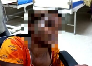 ডিভোর্সর বদলা নিতে বধুর উপর অ্যাসিড হামলা অভিযোগ প্রাক্তন স্বামীর বিরুদ্ধে