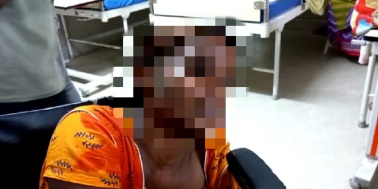 ডিভোর্সর বদলা নিতে বধুর উপর অ্যাসিড হামলা অভিযোগ প্রাক্তন স্বামীর বিরুদ্ধে