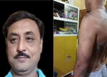 মন্তেশ্বর ব্লক তৃণমূল যুব সভাপতিকে পিটিয়ে প্রাণে মারার চেষ্টা, শাসকদলের পঞ্চায়েত সদস্যসহ ৫ জনের বিরুদ্ধে রুজু হল এফআইআর