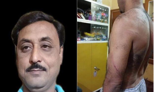 মন্তেশ্বর ব্লক তৃণমূল যুব সভাপতিকে পিটিয়ে প্রাণে মারার চেষ্টা, শাসকদলের পঞ্চায়েত সদস্যসহ ৫ জনের বিরুদ্ধে রুজু হল এফআইআর