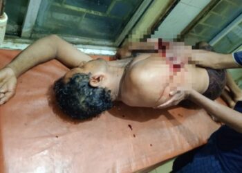 জমিতে গবাদি পশু নামার প্রতিবাদ করায় কৃষককে অস্ত্র দিয়ে নৃসংশভাবে কোপানোর অভিযোগ, গ্রেফতার ৩