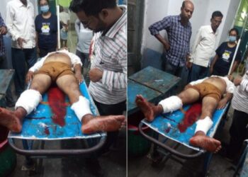 খেলা হবে দিবসে দলীয় কর্মীকে পিটিয়ে দু’পায়ের হাড় ভেঙে দিল রায়নার তৃণমূল নেতা