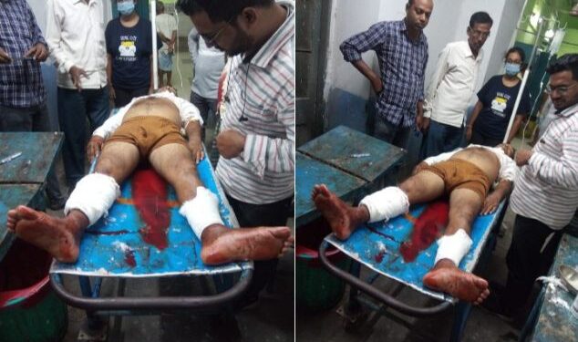 খেলা হবে দিবসে দলীয় কর্মীকে পিটিয়ে দু’পায়ের হাড় ভেঙে দিল রায়নার তৃণমূল নেতা