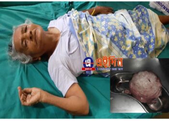 ৮২ বছরের বৃদ্ধার জরায়ুতে ২ কেজি ওজনের টিউমার, অস্ত্রোপচার করে বের করলেন কাটোয়া হাসপাতালের চিকিৎসক