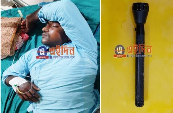 “শয়তান”-এর ঢুকিয়ে দেওয়া ১৪ সেন্টিমিটারের টর্চ যুবকের পায়ূদ্বার থেকে বের করলেন কাটোয়া হাসপাতালের শল্য চিকিৎসক