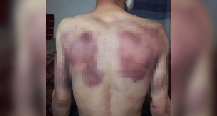 টুপি পরায় দুই বৃদ্ধকে চাবুক দিয়ে বেদম পেটালো তালিবানের জঙ্গিরা