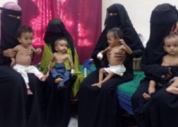 এই মুসলিম দেশে প্রতিদিন অনাহারে মারা যাচ্ছে অসংখ্য শিশু