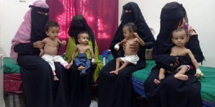 এই মুসলিম দেশে প্রতিদিন অনাহারে মারা যাচ্ছে অসংখ্য শিশু