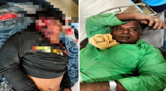 রাস্তায় দাঁড়িয়ে থাকা বিকল লরিতে বালি বোঝাই লরির ধাক্কা, নিহত ১, আহত ১