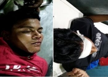 মন্তেশ্বরে স্কুটি-সাইকেল মুখোমুখি সংঘর্ষ, আহত ৩