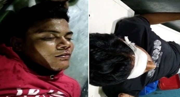 মন্তেশ্বরে স্কুটি-সাইকেল মুখোমুখি সংঘর্ষ, আহত ৩